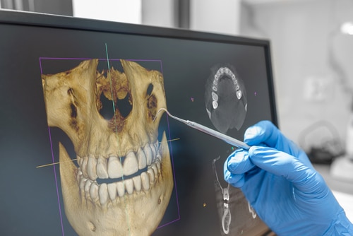 Digital X-rays in Kaysville, UT | Dr. Ruedi Tillmann