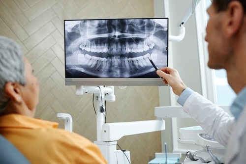 Restorative Dentistry in Salt Lake City, UT | Dr. Ruedi Tillmann