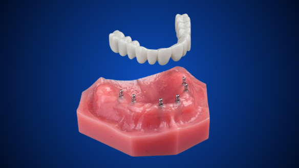 Fix-on-Six in Kaysville, UT | Book a FREE Consultation Today!